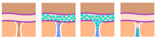 diagramm-schweiss